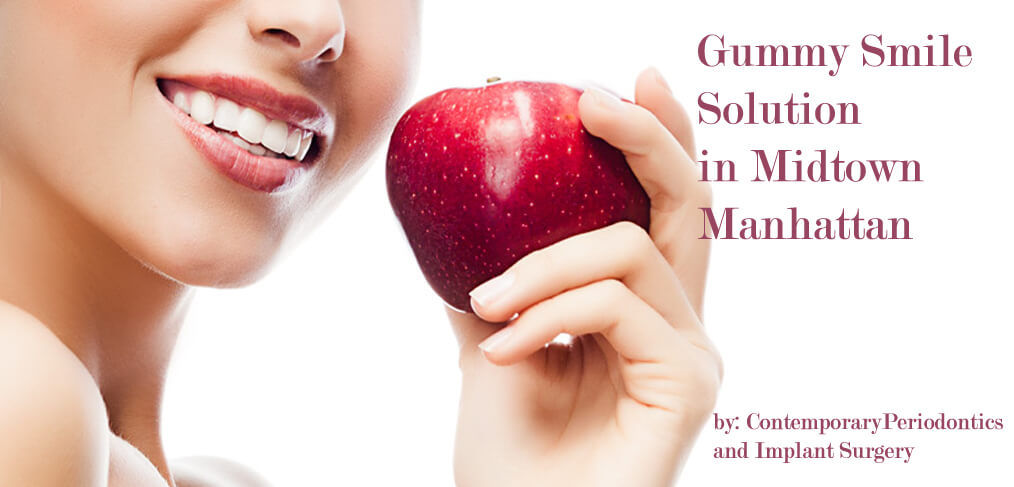 gummy smile solution in midtown Manhattan